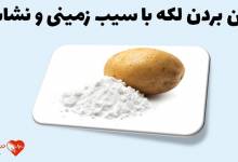 جوش صورت نشانه چیست؟ چی باعث میشه؟