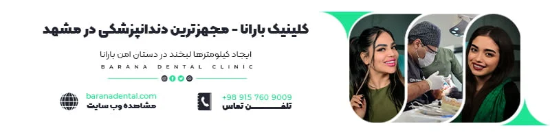 پر کاربردترین سوالات درباره لمینت دندان