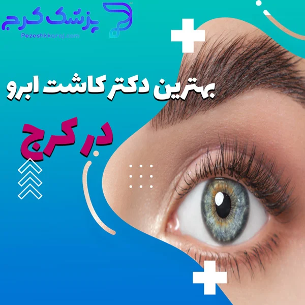 هزینه کاشت ابرو چقدر است و چطور محاسبه می شود؟