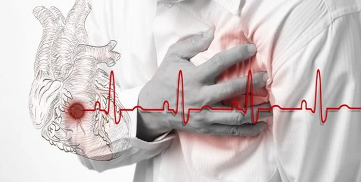 پیس میکر قلب در اصفهان - دکتر حکمت