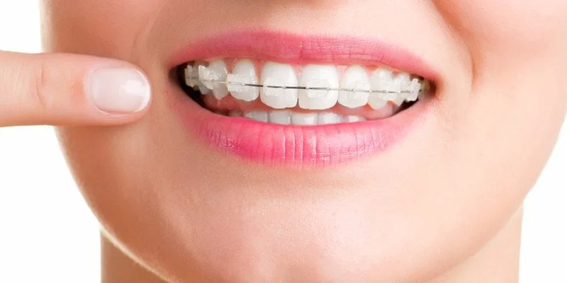 چرا درمان ارتودنسی حائز اهمیت است؟