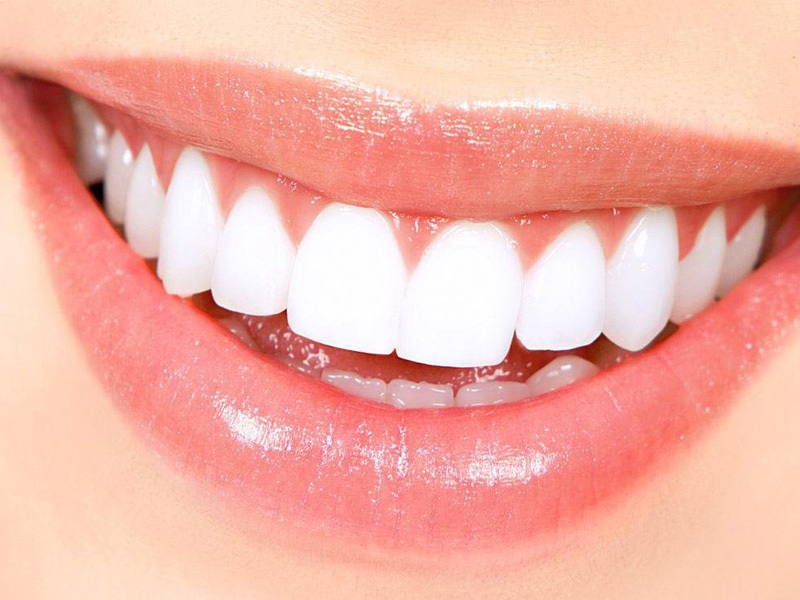 ۱۰ روش برای سفید کردن طبیعی دندان‌ها