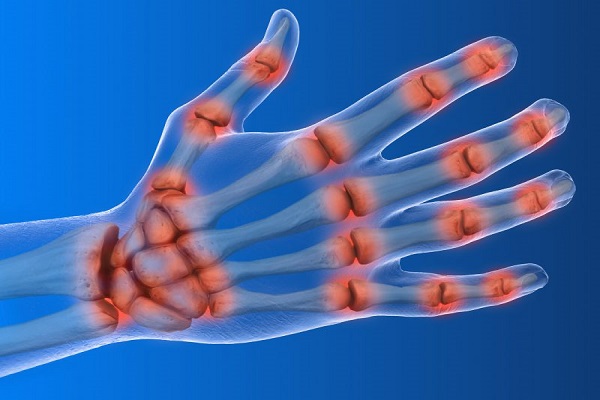 Treatment of nerve pain in the left hand