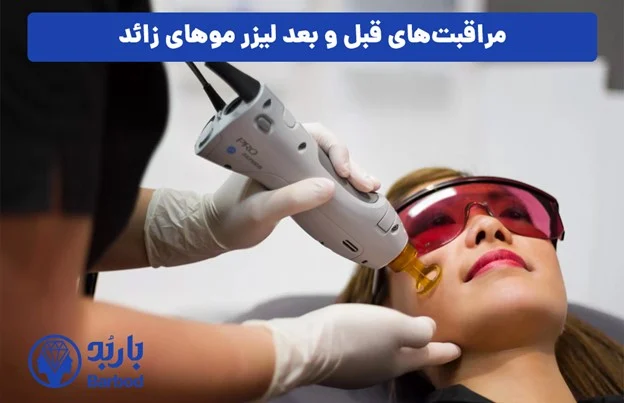 لیزر رفع موهای زائد در تهران + هزینه