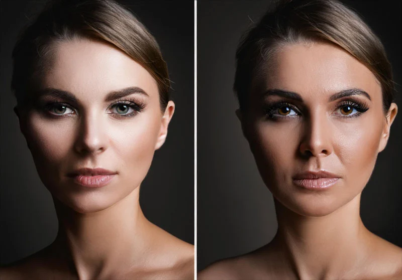 کدوم مدل جراحی رو انتخاب بکنیم؟
