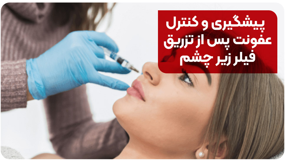 پیشگیری و کنترل عفونت پس از تزریق فیلر زیر چشم