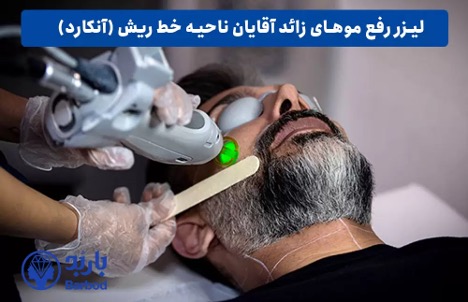 لیزر موهای زائد صورت آقایان: راهکاری بدون التهاب و جای زخم