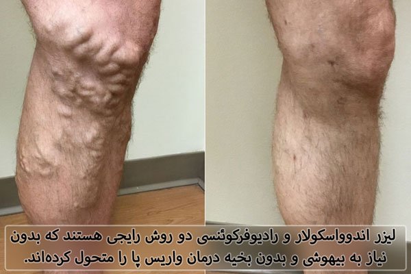 بیماری هایی که در کمین مشاغل ایستادنی و نشستنی هستند! - خبرگزاری آنلاین | اخبار ایران و جهان