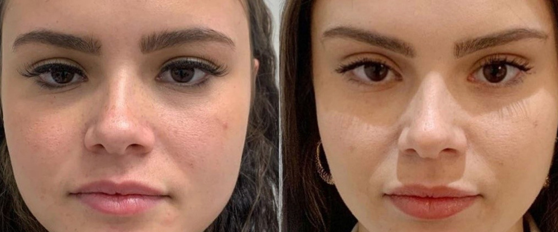 معیارهای انتخاب بهترین کرم و سرم لیفت صورت