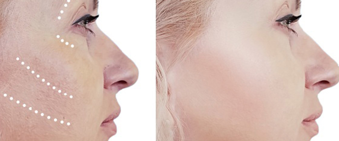 معرفی جدیدترین کرم های لیفت صورت برای سفتی و فرم دهی طبیعی