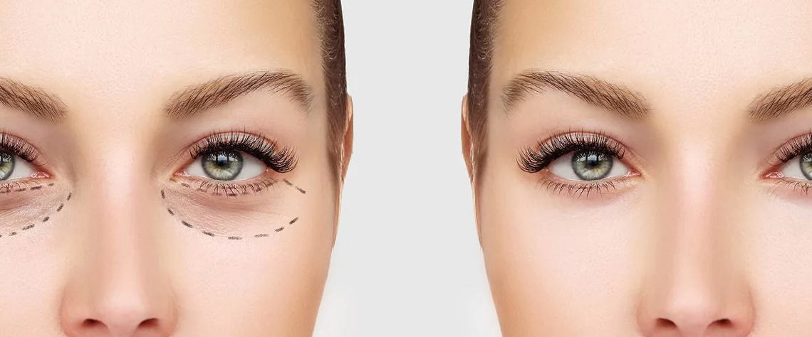 آبرسان |پوست اشتباهات رایج در استفاده از کرم و سرم لیفت