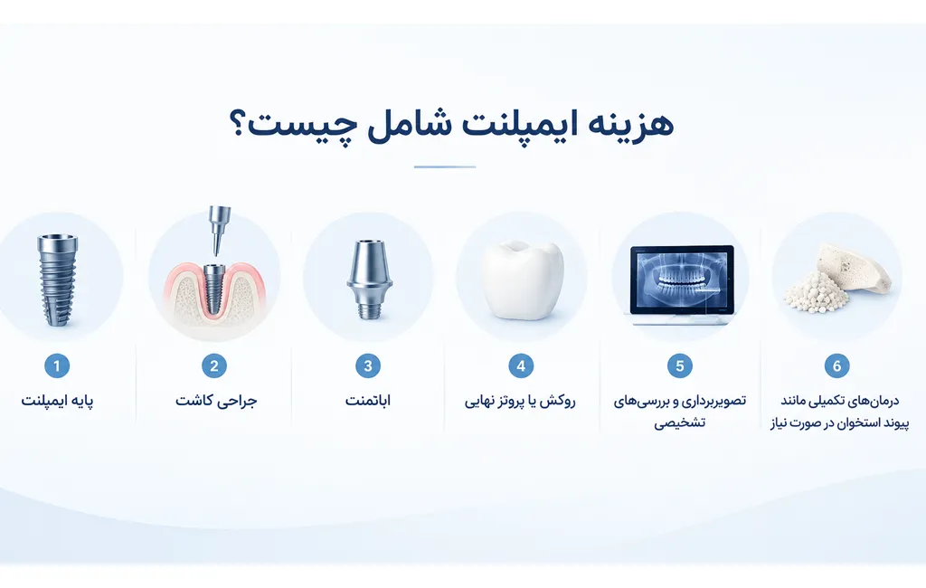 هزینه ایمپلنت شامل چه مواردی است؟