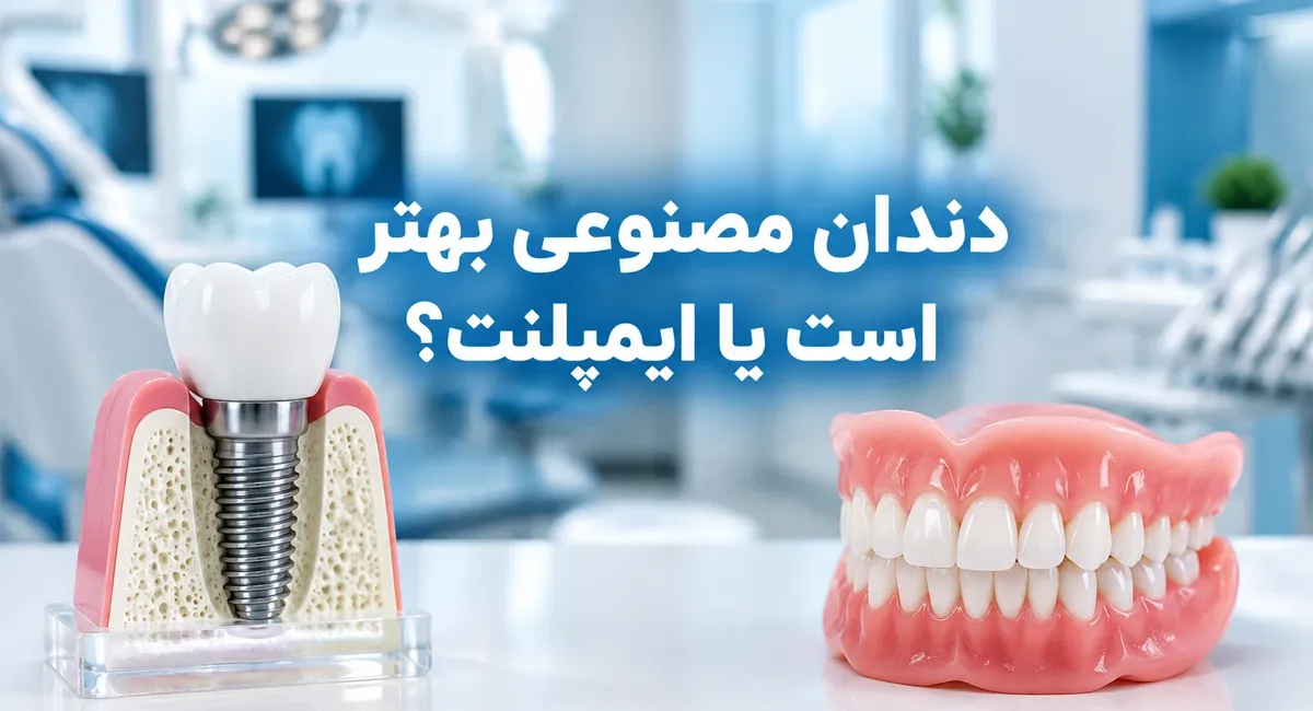 دندان مصنوعی یا ایمپلنت؛ بهترین انتخاب برای شما کدام است؟